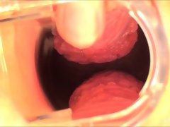 Anaal, Jurk, Extreem, Gapende, Masturbatie, Orgasme, Openbaar, Alleen