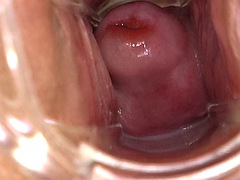 Tussi, Fetisch, Gynäkologe