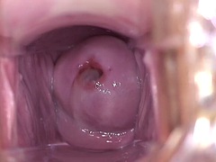 美女, フェティッシュ, 婦人科